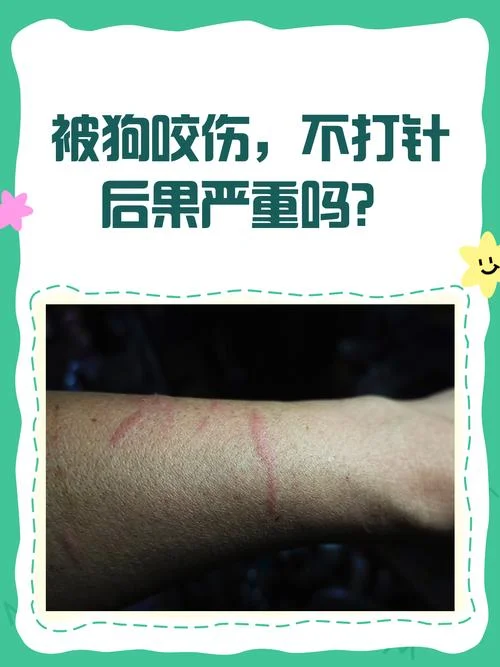 梦见被黑狗咬手没出血_2
