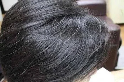 女人梦见男人满头白发-女人梦见男人满头白