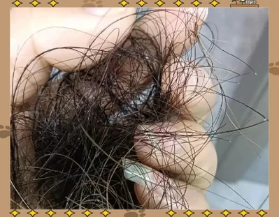 梦见自己头发大把掉是什么预兆_1