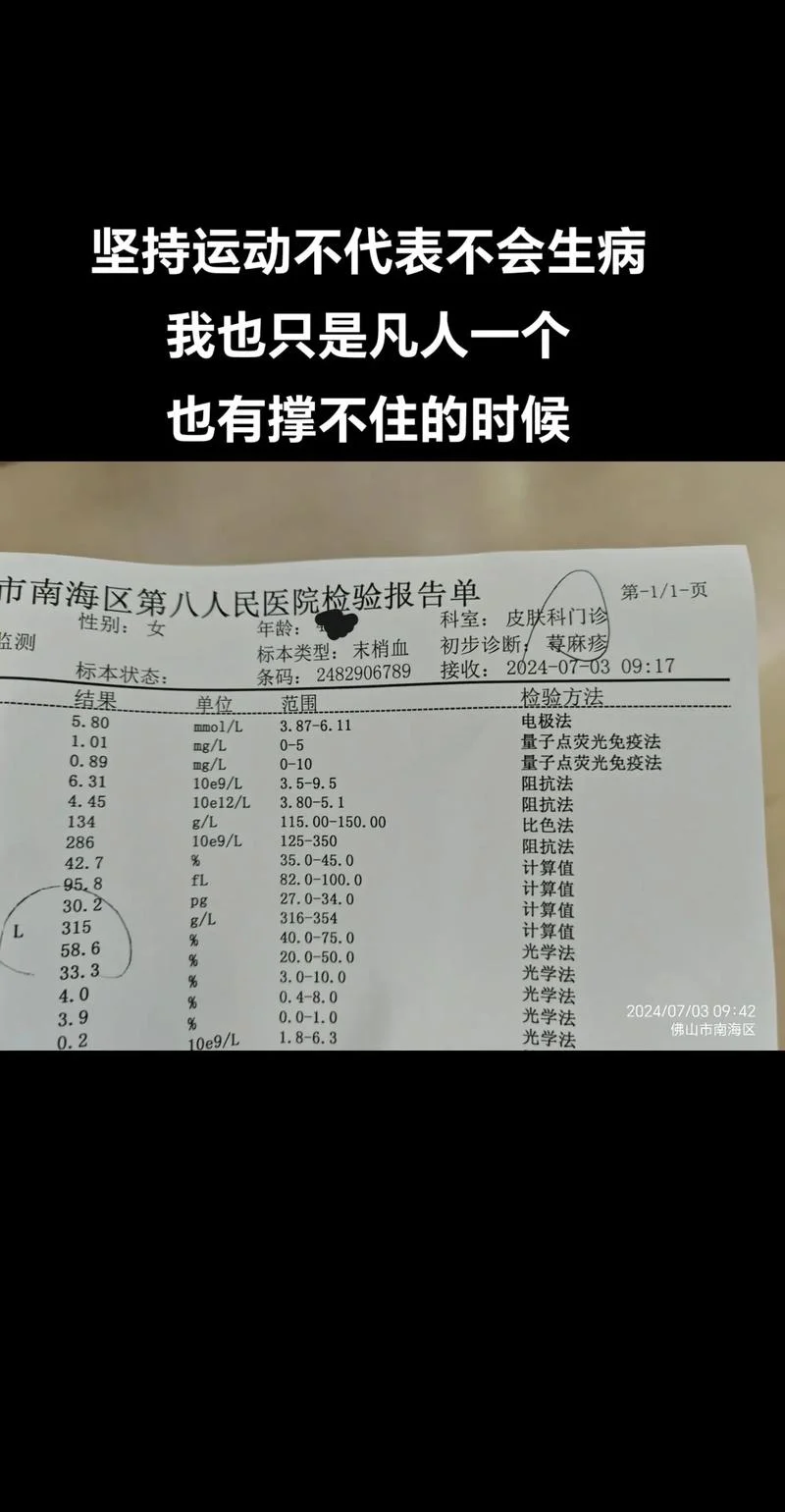 如何查免疫力是否低下-查免疫力低下方法