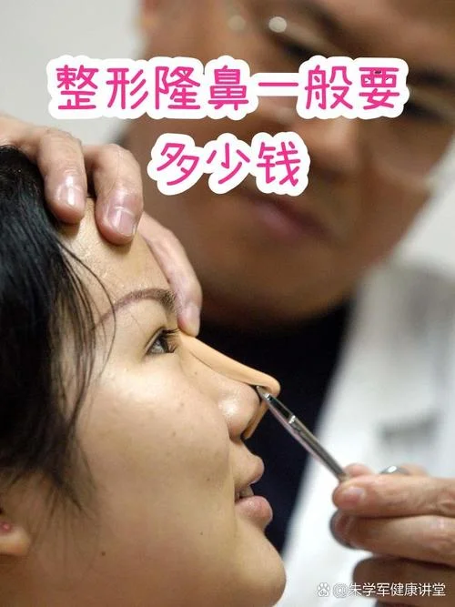 隆鼻手术的费用是多少钱_1