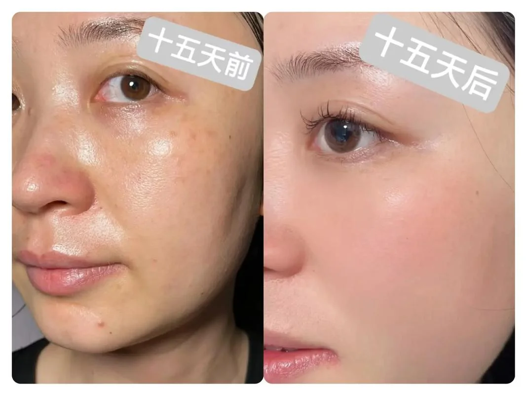 梦见别的女人脸上长斑_1