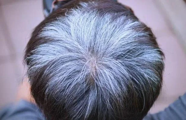 梦见头发长_1
