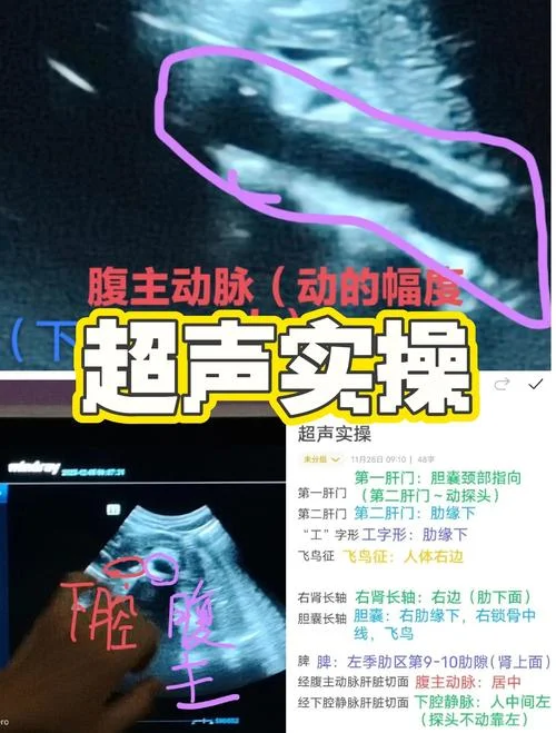 超声原理及生物医学工程应用_1