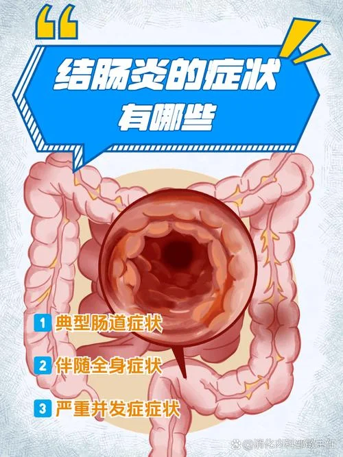 滤泡性肠炎哪一年考了_1