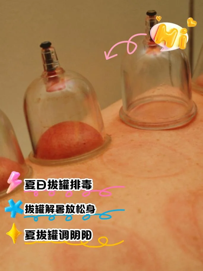产品拔罐减肥原理-产品拔罐减肥原理