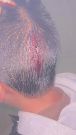 梦到头被砍掉了_2