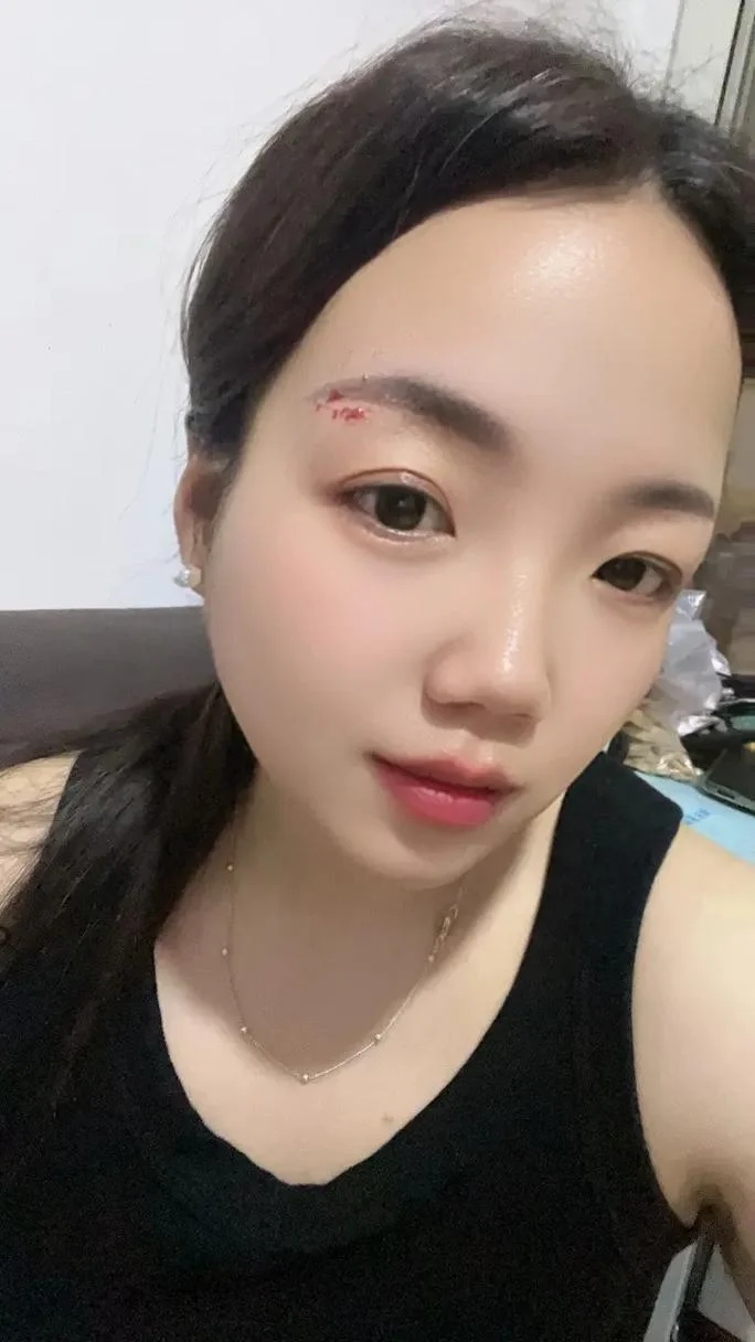梦见自己的眉毛被刮了_1