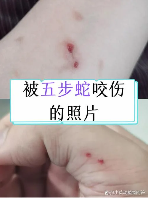 做梦梦到蛇咬自己的手_1