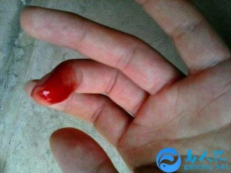 梦见自己把小孩打出血是什么意思_1