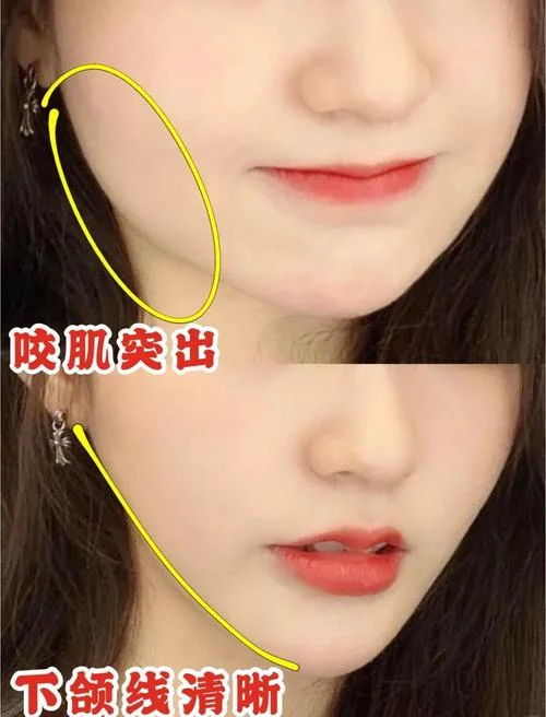 超声波瘦脸原理_1