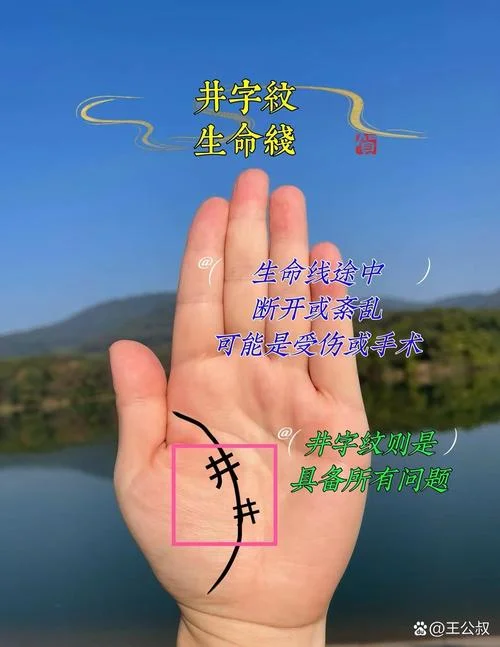 男人左手掌心有痣手相-男掌有痣手相