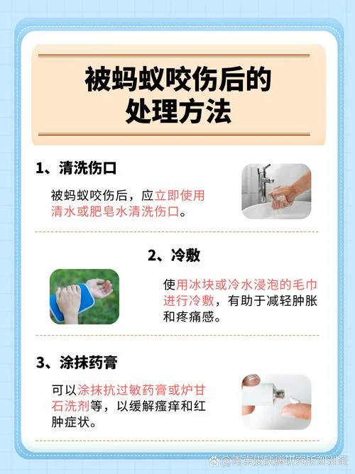 蚂蚁爱咬什么人体质_1