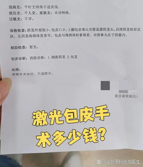 包皮切除大概需要花多少钱-包皮切除费用多少