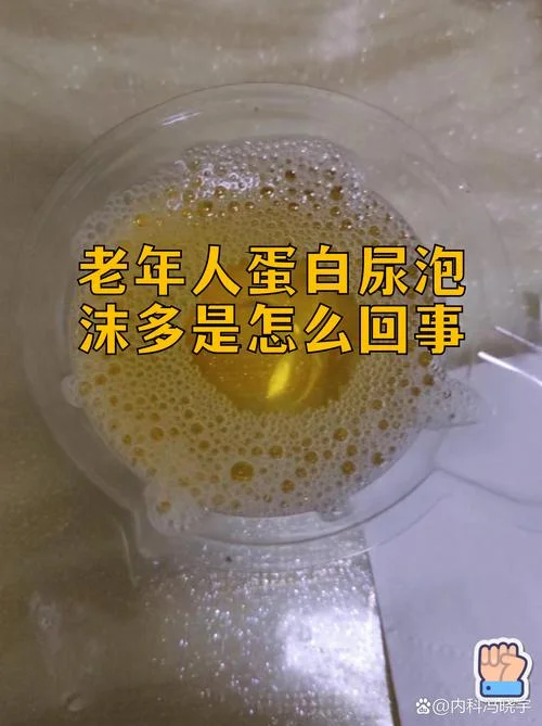 梦见别人小便尿我身上_1