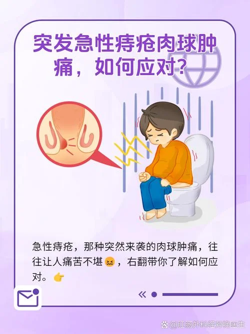 痔疮又痛又痒怎么办_1