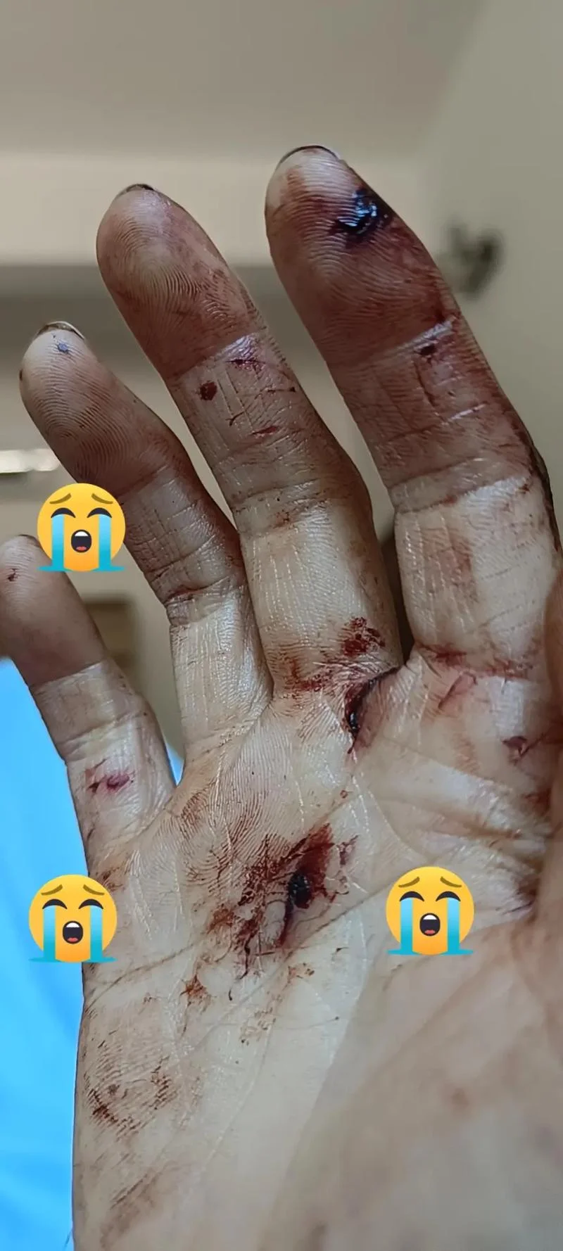 做梦梦到被人打惨了_2