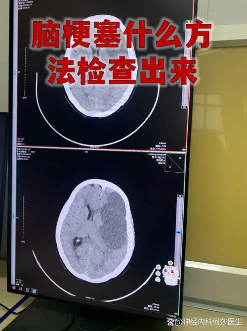 头部磁共振多少钱_1