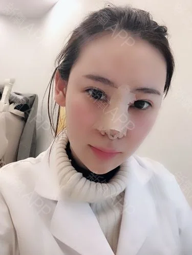 梦见别人做鼻子_1