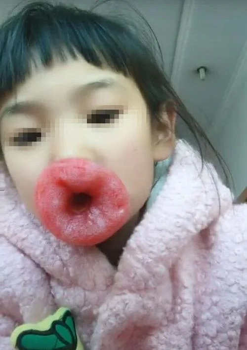 梦见小女孩手腕肿了_1