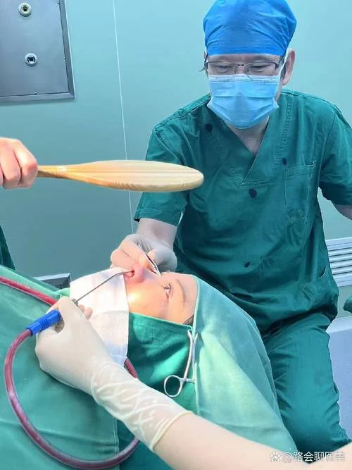 打鼾手术是怎么做的_1