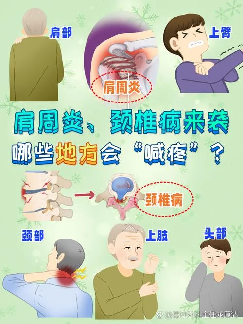 肩周炎颈椎疼痛怎么办_1