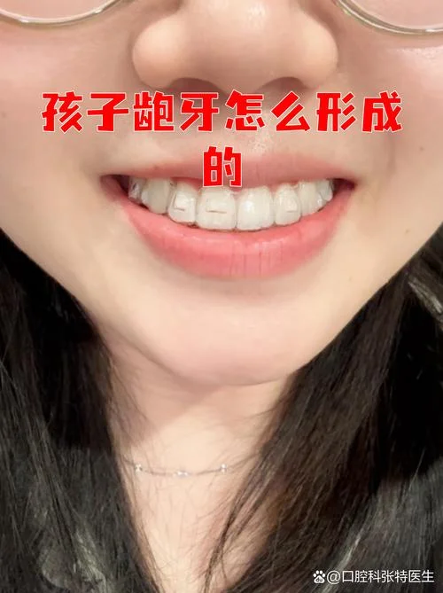 梦见龅牙门牙掉了一半-梦见门牙掉一半
