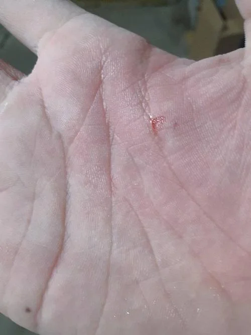梦见狗咬我的手掌_1