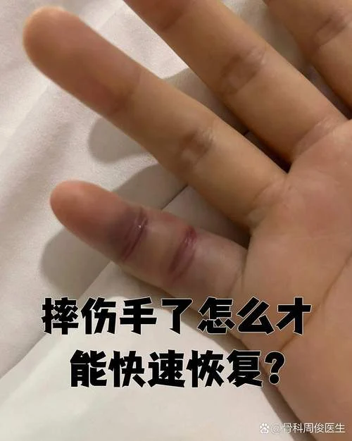 梦见手受伤很严重_1