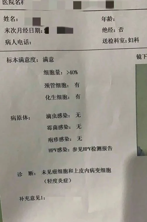 长沙白带常规检查项目_1