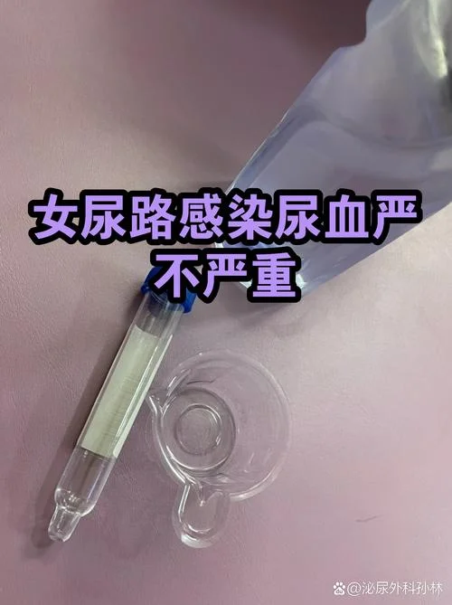 女性尿路感染血尿怎么办_1