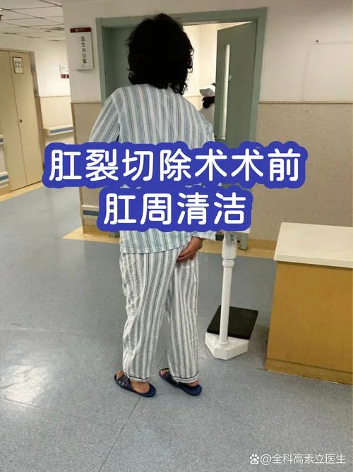 做肛裂手术多少钱_2