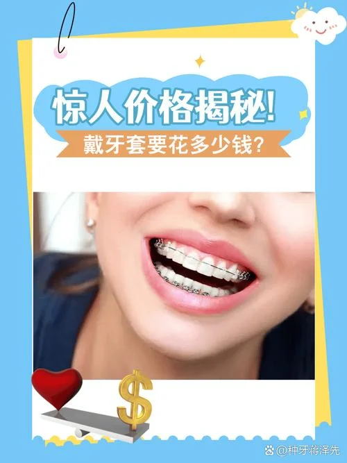 成年人矫正牙齿要多少钱_1