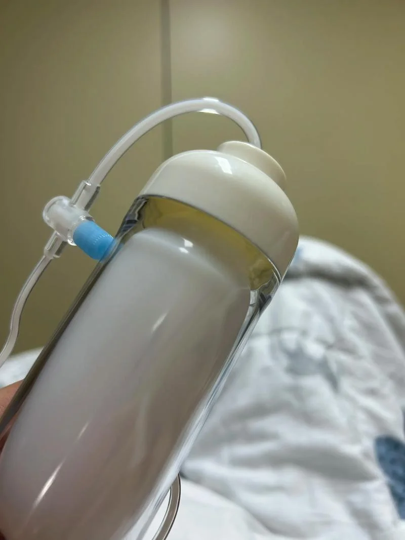 镇痛泵一般多少钱一台_2