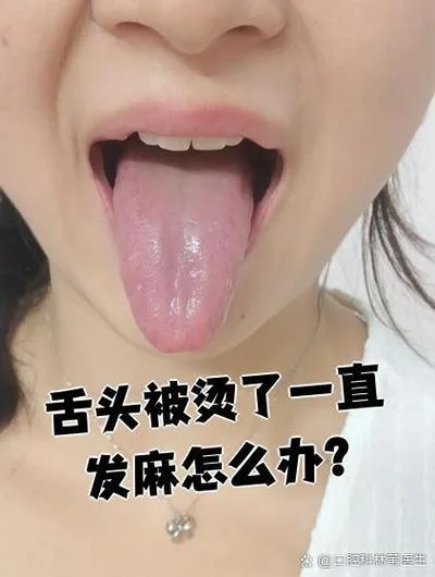 舌苔被烫没有了怎么办_1
