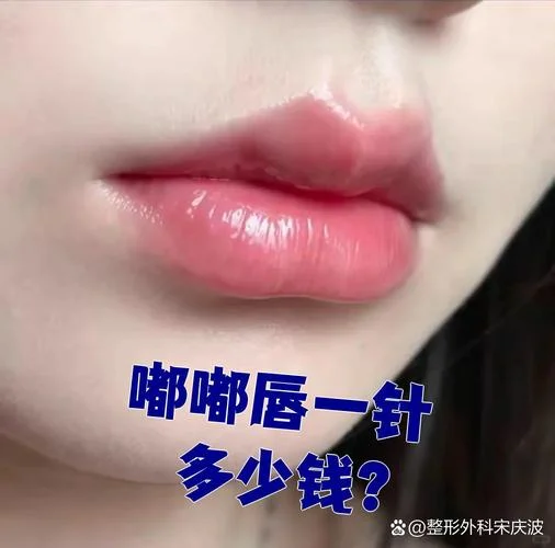 嘴唇手术要多少钱_2