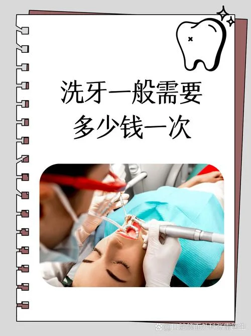 洗黄牙要多少钱_1