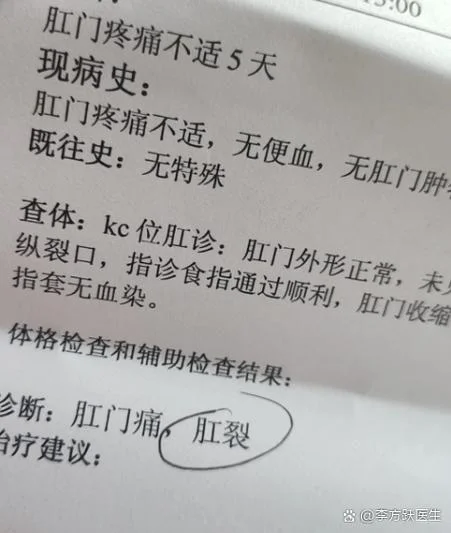 肛门怎么检查多少钱_2