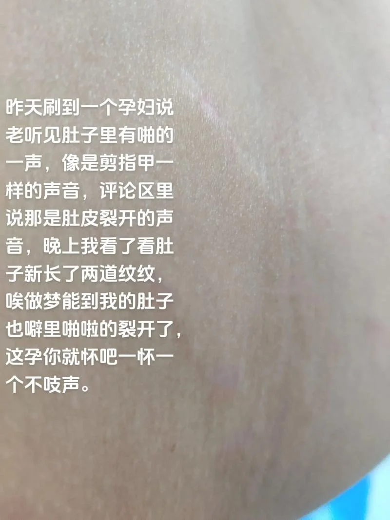 孕妇做梦梦到长妊娠纹_1