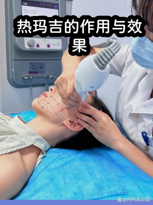 热玛吉射频原理_1