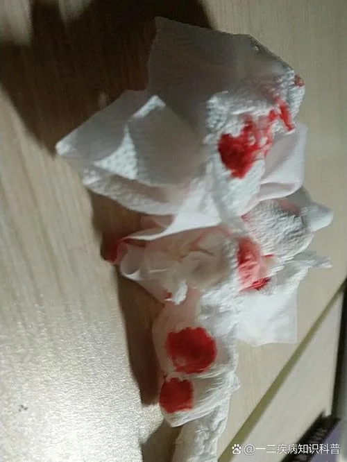 做梦梦到到处流血_2