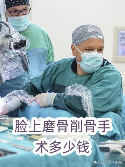 面部磨骨大概多少钱_2