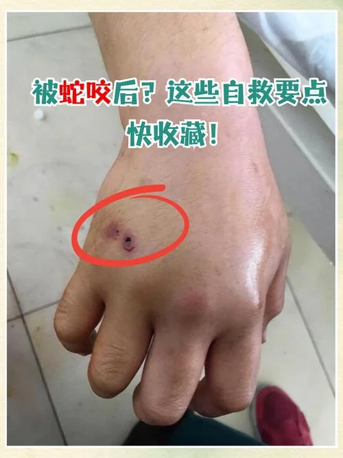 梦到被黑蛇咬_1