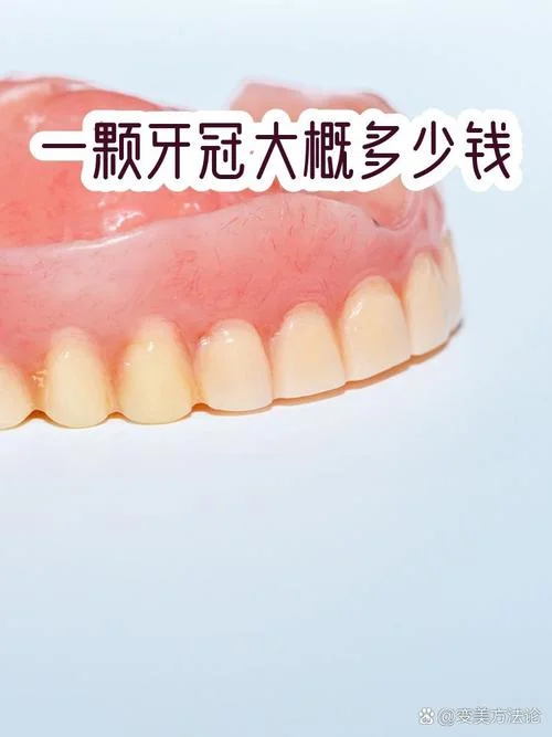 做牙冠多少钱一颗能保几年_1