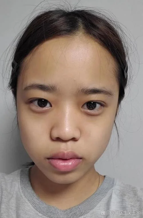 女人鼻翼宽面相好吗_2