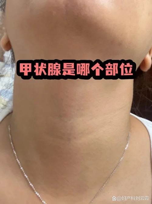 
                                    甲状腺六区在哪个位置-甲状腺六区定位