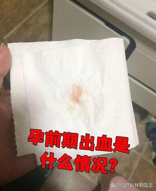 怀孕梦见下面出血_2