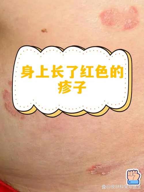 红皮肤是哪个国家的人_2