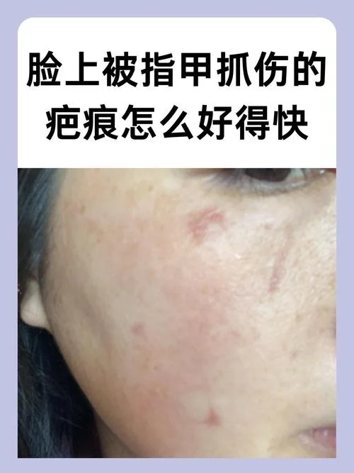 脸被抓伤要求赔偿多少钱-脸被抓伤索赔多少