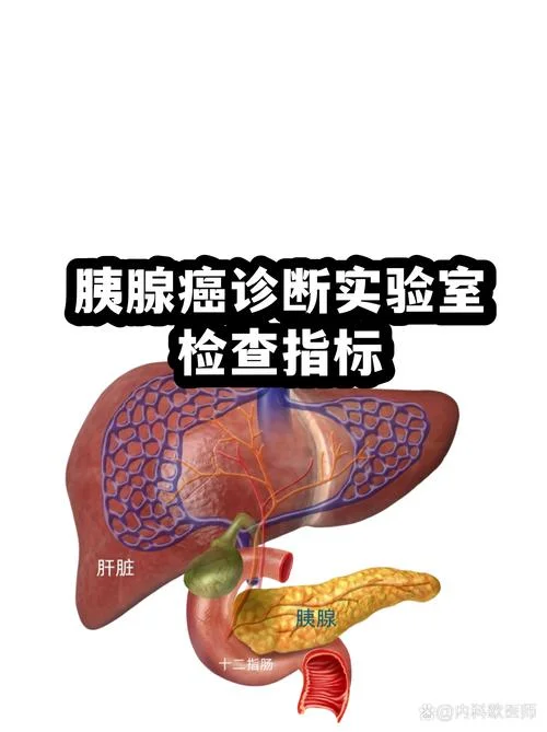 如何查胰腺癌_1